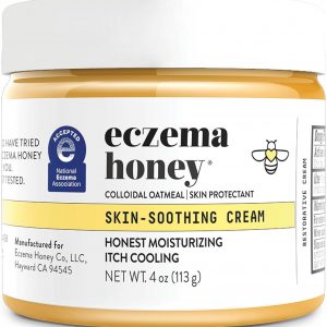 Eczema