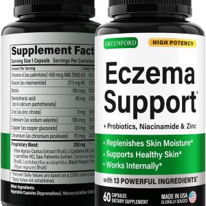 Eczema